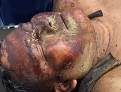 Ali Murdani Manurung Diborgol Saat Luka Parah, Kuasa Hukum Desak Penegakan Hukum Humanis di Konflik Lahan Eks HGU 366 Hektar