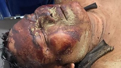 Ali Murdani Manurung Diborgol Saat Luka Parah, Kuasa Hukum Desak Penegakan Hukum Humanis di Konflik Lahan Eks HGU 366 Hektar